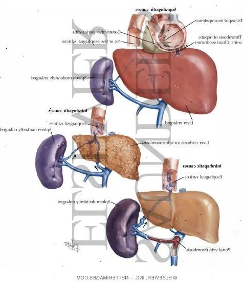 Forberedelser til din avtale. Blodpropp (trombose). Forberedelser til din avtale. Blodpropp (trombose).