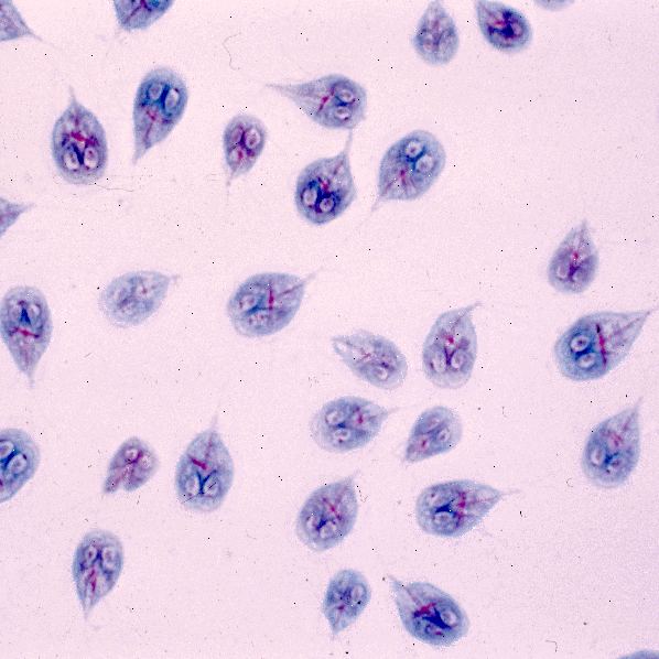 Giardia-infeksjon (giardiasis). Svelge forurenset vann. Giardia-infeksjon (giardiasis). Svelge forurenset vann.