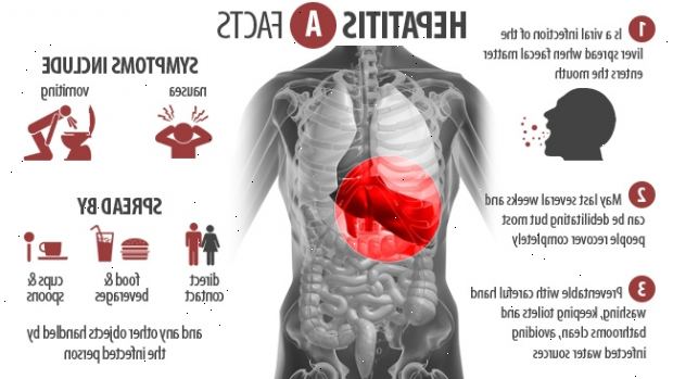 Hepatitt A. Løpende tegn og symptomer på hepatitt A. Hepatitt A. Løpende tegn og symptomer på hepatitt A.