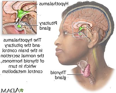 Forberedelser til din avtale. Grunner til for mye tyroksin (t-4). Forberedelser til din avtale. Grunner til for mye tyroksin (t-4).