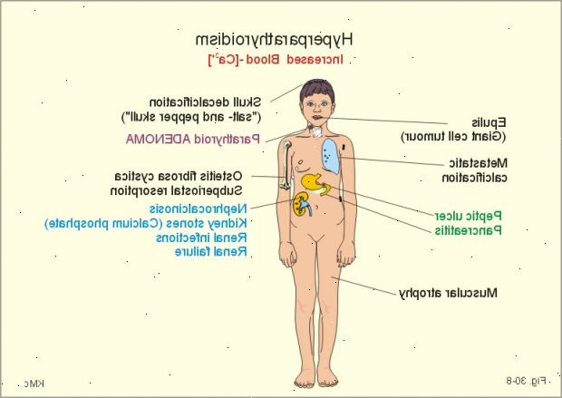 Forberedelser til din avtale. Arvelig hypoparathyroidism. Forberedelser til din avtale. Arvelig hypoparathyroidism.