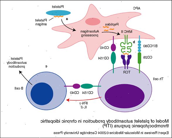 Idiopatisk trombocytopenisk purpura (ITP). Nyere virusinfeksjon. Idiopatisk trombocytopenisk purpura (ITP). Nyere virusinfeksjon.