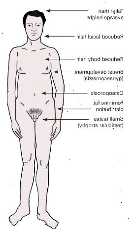 Klinefelter syndrom. Bremse utviklingen i spedbarnsalder eller guttedagene. Klinefelter syndrom. Bremse utviklingen i spedbarnsalder eller guttedagene.