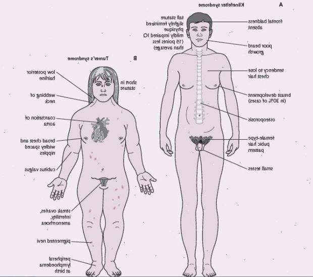 Forberedelser til din avtale. Testosteronbehandling. Forberedelser til din avtale. Testosteronbehandling.