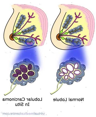 Forberedelser til din avtale. Du har tatt hormonbehandling for overgangsalder. Forberedelser til din avtale. Du har tatt hormonbehandling for overgangsalder.