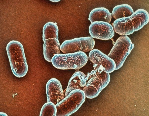 Listeria-infeksjon. Symptomer under graviditet og for nyfødte. Listeria-infeksjon. Symptomer under graviditet og for nyfødte.