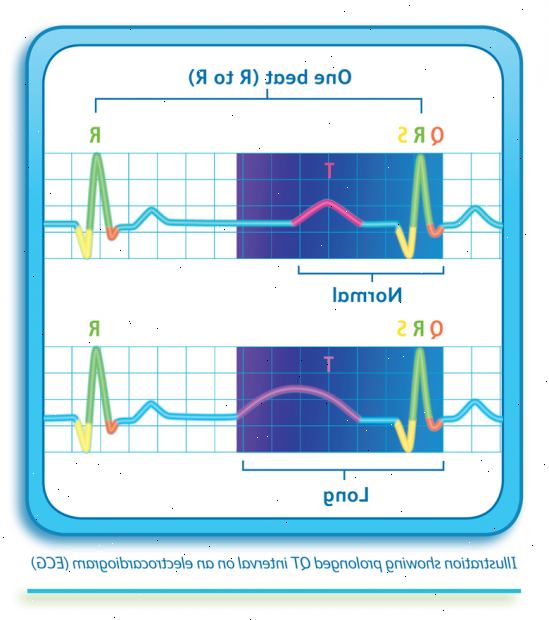 Forberedelser til din avtale. Arvet lang QT syndrom. Forberedelser til din avtale. Arvet lang QT syndrom.