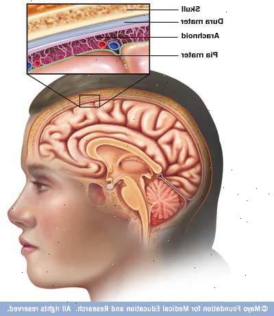 Forberedelser til din avtale. Neisseria meningitidis (meningokokker). Forberedelser til din avtale. Neisseria meningitidis (meningokokker).