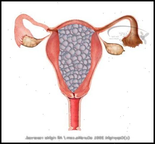 Blæremola. Forrige blæremola. Blæremola. Forrige blæremola.