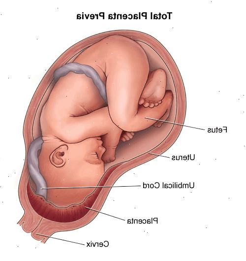 Forberedelser til din avtale. Sørge for å bringe et familiemedlem eller en venn. Forberedelser til din avtale. Sørge for å bringe et familiemedlem eller en venn.