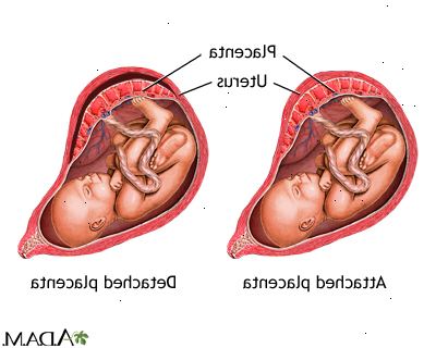 Forberedelser til din avtale. Prematur ruptur av membranene. Forberedelser til din avtale. Prematur ruptur av membranene.