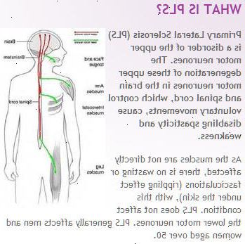 Livsstil og hjem rettsmidler. Electromyogram (EMG). Livsstil og hjem rettsmidler. Electromyogram (EMG).