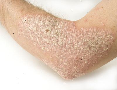 Forberedelser til din avtale. Virus og bakterieinfeksjoner. Forberedelser til din avtale. Virus og bakterieinfeksjoner.