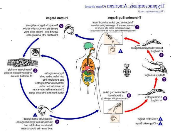Forberedelser til din avtale. Utvidelse av tykktarmen (megacolon). Forberedelser til din avtale. Utvidelse av tykktarmen (megacolon).