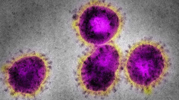Alvorlig akutt respiratorisk syndrom (SARS). Bruk engangshansker. Alvorlig akutt respiratorisk syndrom (SARS). Bruk engangshansker.
