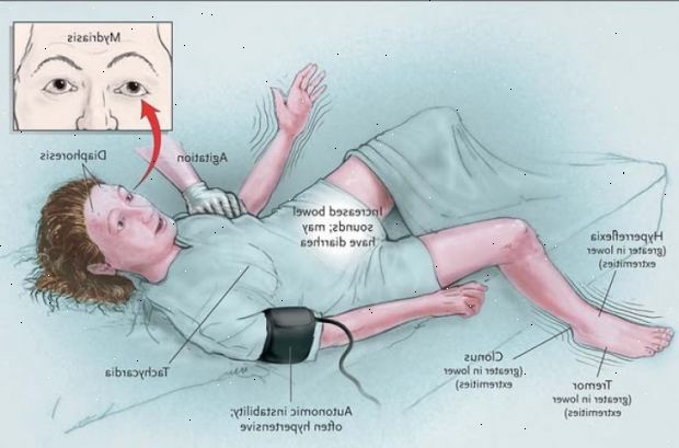 Forberedelser til din avtale. Serotonin og noradrenalin reopptakshemmere (SNRI). Forberedelser til din avtale. Serotonin og noradrenalin reopptakshemmere (SNRI).