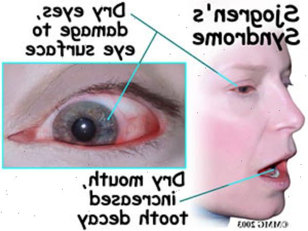 Forberedelser til din avtale. Spytt scintigrafi. Forberedelser til din avtale. Spytt scintigrafi.