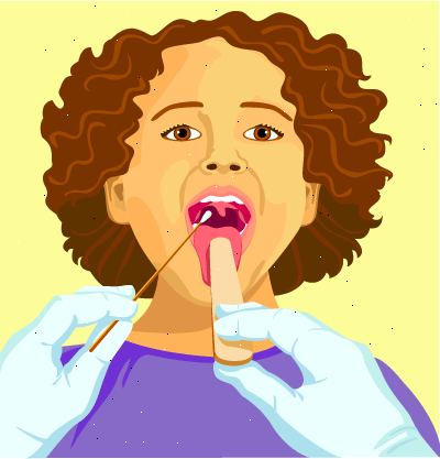 Strep hals. Betennelsesreaksjoner. Strep hals. Betennelsesreaksjoner.