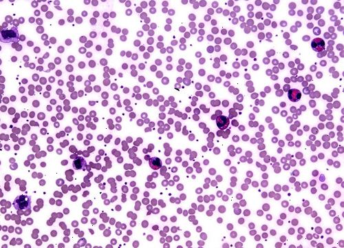 Eosinofili. Ødelegge fremmede stoffer. Eosinofili. Ødelegge fremmede stoffer.