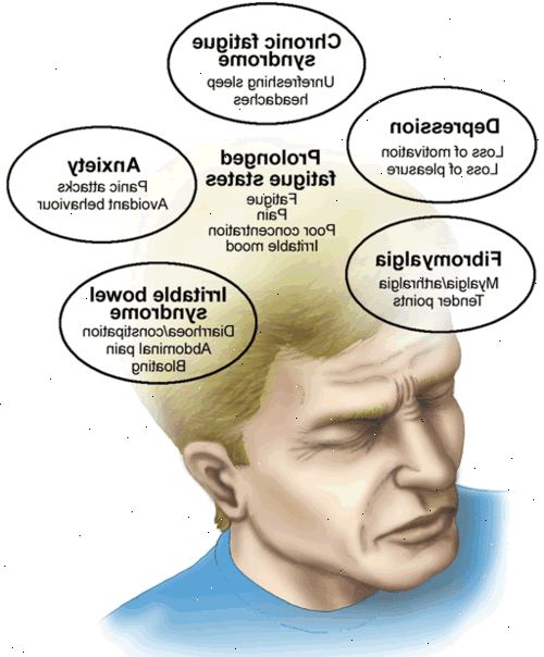 Trøtthet. Psykologiske forhold. Trøtthet. Psykologiske forhold.