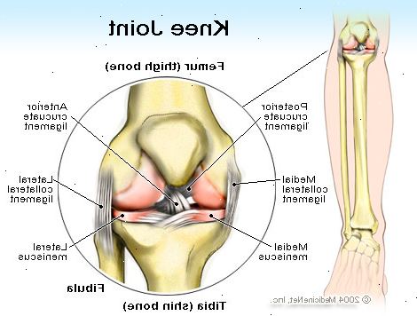 Knesmerter: symptom. Komprimering. Knesmerter: symptom. Komprimering.