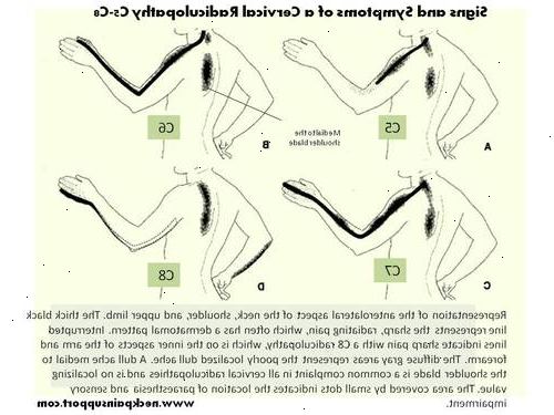 Nakkesmerter: symptom. Is eller varme. Nakkesmerter: symptom. Is eller varme.