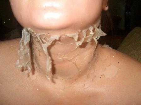 Peeling huden. Forstyrrelser i immunsystemet. Peeling huden. Forstyrrelser i immunsystemet.