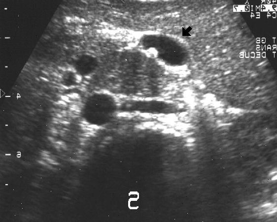 Abdominal ultralyd. Andre mulige årsaker til at du kan ha en abdominal ultralyd. Abdominal ultralyd. Andre mulige årsaker til at du kan ha en abdominal ultralyd.