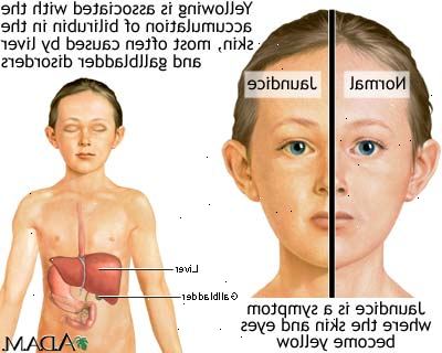 Bilirubin test. Leverfunksjonstester. Bilirubin test. Leverfunksjonstester.