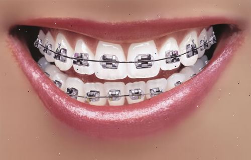 Tannregulering. Kortere rot lengder. Tannregulering. Kortere rot lengder.