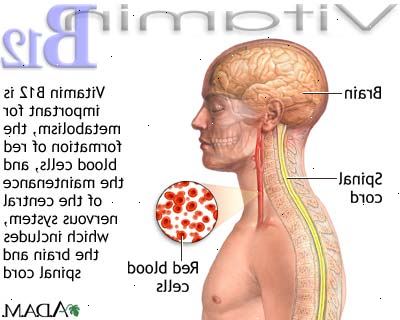 Vitamin mangel anemi. Folat mangel anemi. Vitamin mangel anemi. Folat mangel anemi.