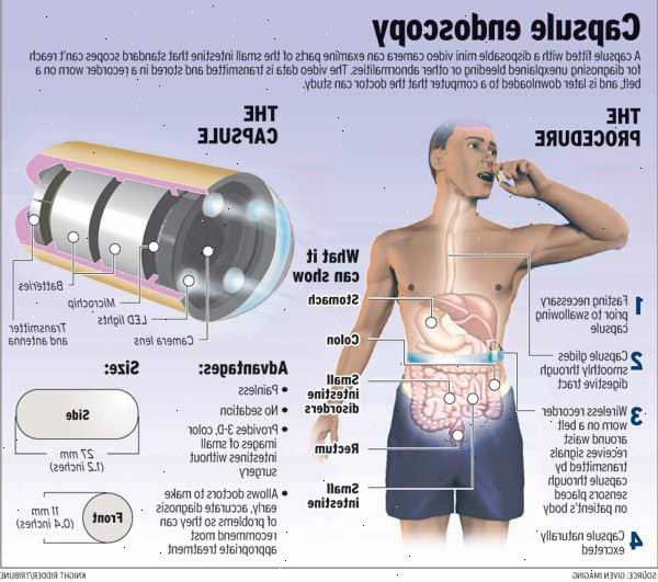 Kapsel endoskopi. Obscure gastrointestinal blødning. Kapsel endoskopi. Obscure gastrointestinal blødning.
