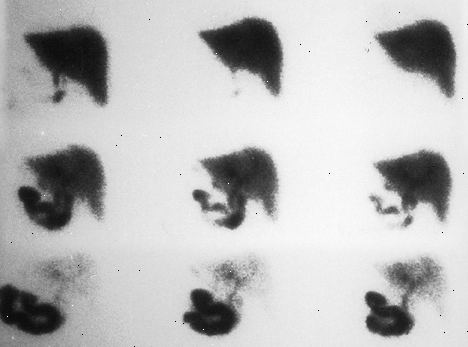 HIDA scan. Fast for noen timer. HIDA scan. Fast for noen timer.