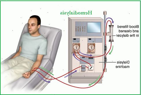 Høyt blodtrykk (hypertensjon). Betennelse av membranen som omgir hjertet (perikarditt). Høyt blodtrykk (hypertensjon). Betennelse av membranen som omgir hjertet (perikarditt).