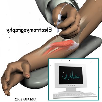 Elektromyografi (EMG). Elektroder. Elektromyografi (EMG). Elektroder.