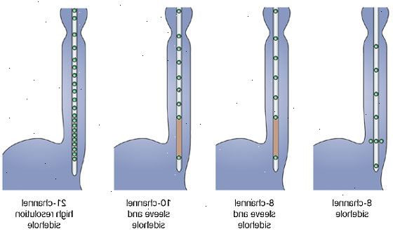 Esophageal manometry. Etter esophageal manometry. Esophageal manometry. Etter esophageal manometry.