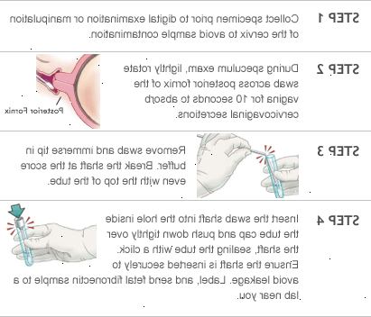 Fetal fibronectin test. Positive. Fetal fibronectin test. Positive.
