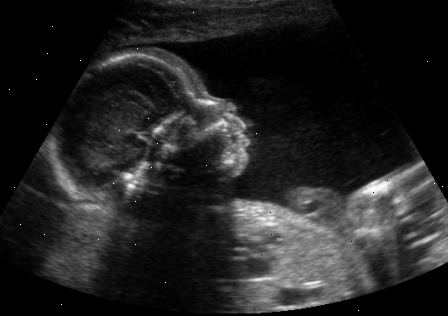 Bestem babyens svangerskapslengde. Bekrefte antall babyer. Bestem babyens svangerskapslengde. Bekrefte antall babyer.
