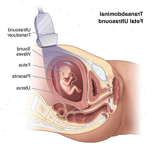 Første trimester screening. Invasiv prenatal testing. Første trimester screening. Invasiv prenatal testing.