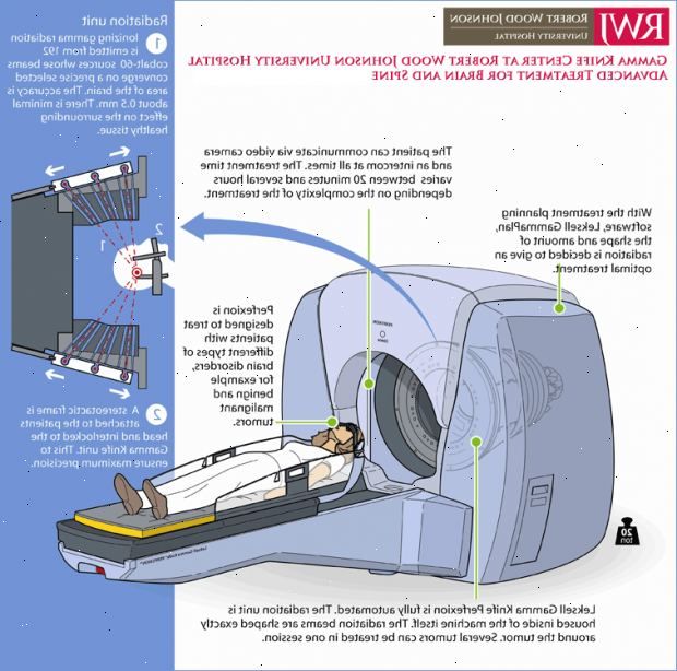Gamma kniv radiosurgery. Arteriovenøs malformasjon (AVM). Gamma kniv radiosurgery. Arteriovenøs malformasjon (AVM).