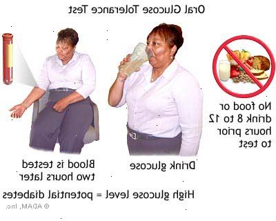 Glukose toleranse test. Type 2 diabetes. Glukose toleranse test. Type 2 diabetes.