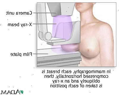 Diagnostisk mammografi. Når du skal begynne screening mammografi. Diagnostisk mammografi. Når du skal begynne screening mammografi.