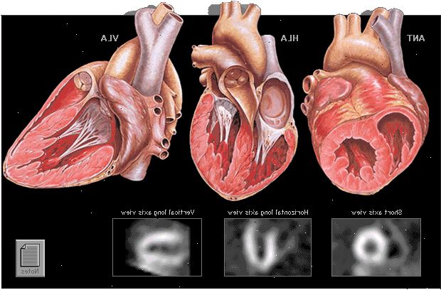 Kjernefysisk stress test. Diagnostisere koronarsykdom. Kjernefysisk stress test. Diagnostisere koronarsykdom.