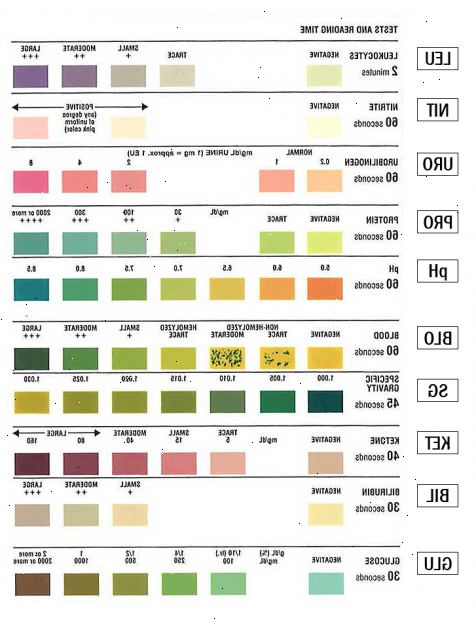Urinalysis. For å vurdere din generelle helse. Urinalysis. For å vurdere din generelle helse.