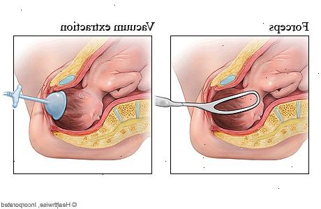 Babyens hjerterytme antyder et problem. Du har en helse bekymring. Babyens hjerterytme antyder et problem. Du har en helse bekymring.