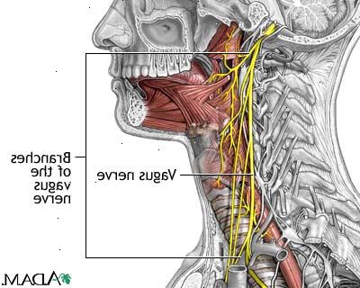 Vagus nerve stimulering. Definisjon. Vagus nerve stimulering. Definisjon.