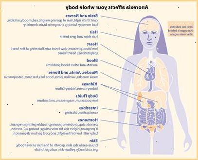 Anorexia nervosa. Sport, arbeid og kunstneriske aktiviteter. Anorexia nervosa. Sport, arbeid og kunstneriske aktiviteter.