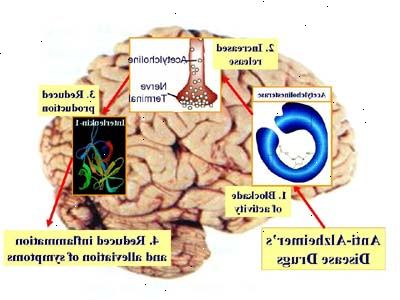 Alzheimers sykdom. Immunisering strategier. Alzheimers sykdom. Immunisering strategier.