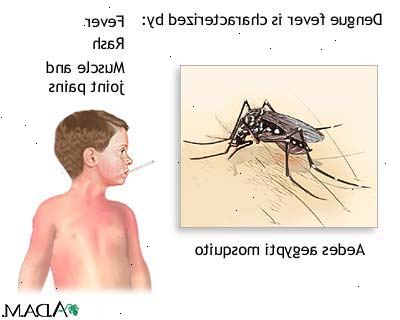 Viral hemoragisk feber. Symptomer kan bli livstruende. Viral hemoragisk feber. Symptomer kan bli livstruende.