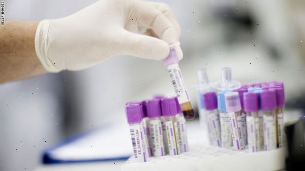 Prostatakreft. Prostatakreft screening: bør du få en PSA-test? Prostatakreft. Prostatakreft screening: bør du få en PSA-test?